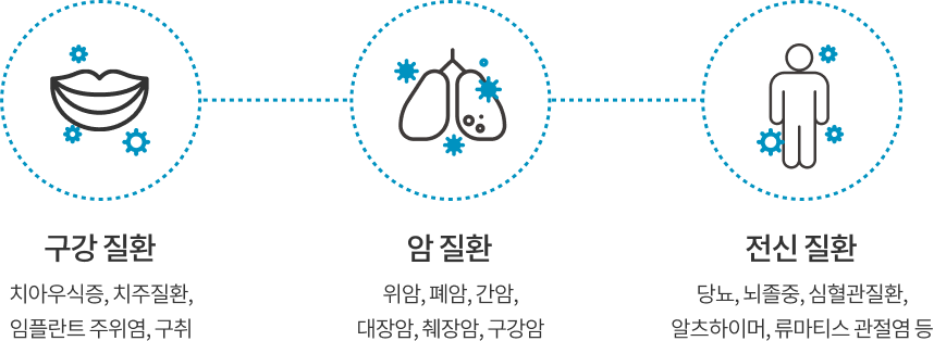 치아우식,치주질환,임플란트주위염,구취