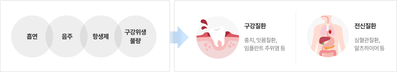 구강유해균과 다양한 질환 그림설명
